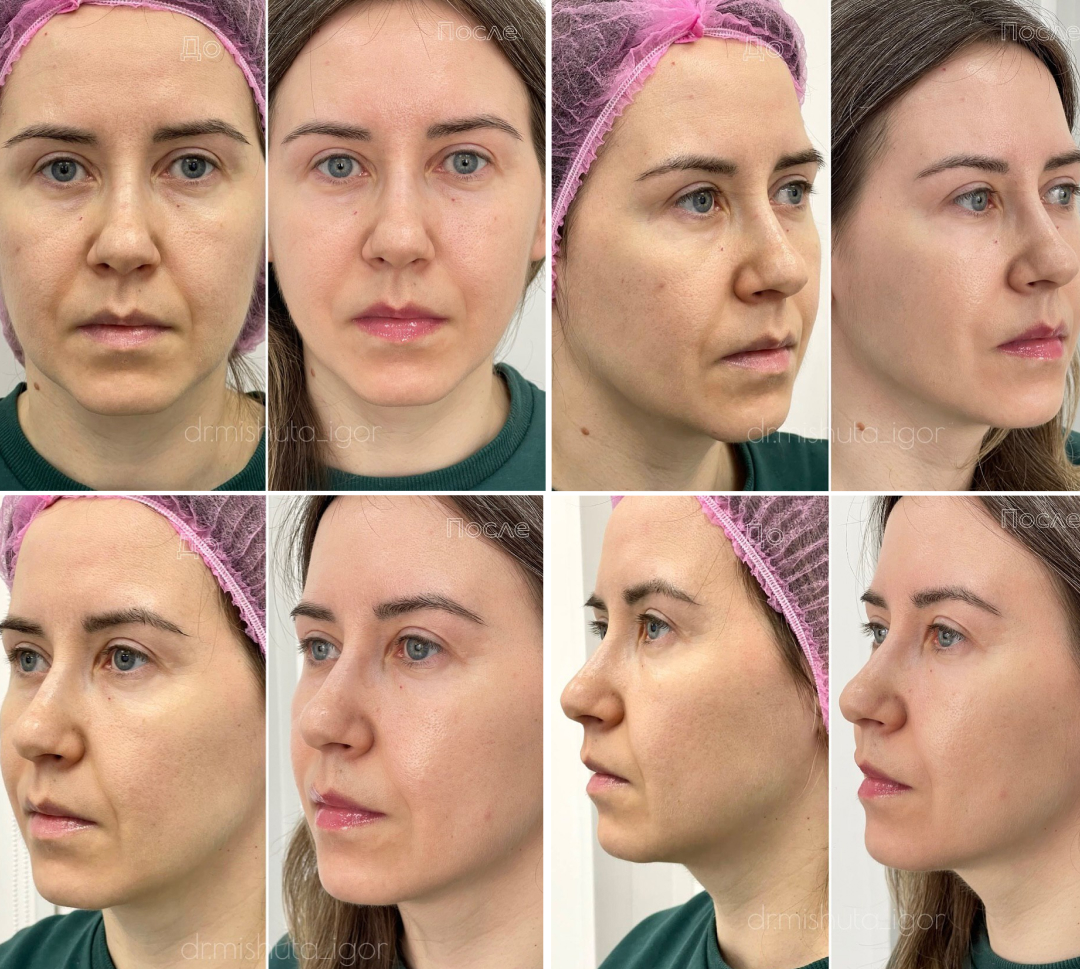 ДО СМАС И ПОСЛЕ.jpg