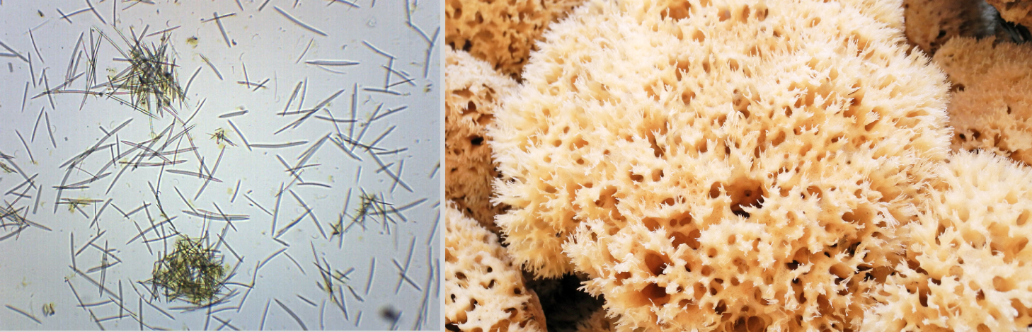 Как выглядят спикулы.jpg